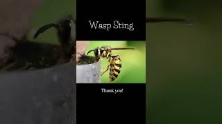 Wasp Sting [upl. by Nyrmac]