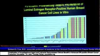 SABCS2012PK1 Judy C Boughey Rochester USA [upl. by Hoye394]