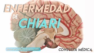 Sistema nervioso Enfermedad de Arnold Chiari [upl. by Aicat]