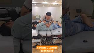 Cervical and Lumbar Spondylitis Treatment in India DrMushtaque 🇮🇳 chiropractor Migren sciatica [upl. by Tocci]