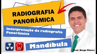 Anatomia radiográfica  panorâmica mandíbula [upl. by Aran346]