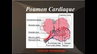 Poumon Cardiaque Oedeme aigu du poumon OAP Physiopathologie de linsuffisance cardiaque gauche [upl. by Quillan827]