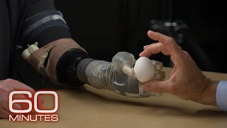 How advancements in prosthetic technology allow feeling control  60 Minutes [upl. by Enrico]