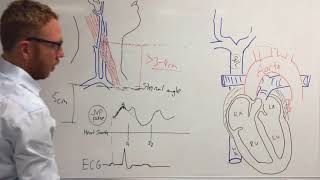 Jugular venous pressure [upl. by Gyatt]