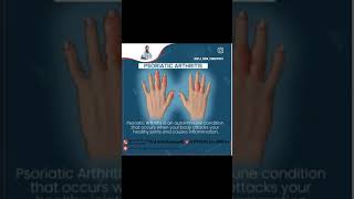 Psoriatic arthritis treatment [upl. by Curry]