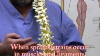 Lower back Pain sports Injuries trauma self treatment [upl. by Suiluj164]