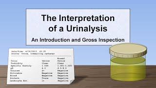 Interpretation of the Urinalysis Part 1  Introduction and Inspection [upl. by Batista799]