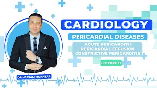 Cardiology ll Pericardial Diseases ll  Acute pericarditis amp Pericardial effusion amp CP [upl. by Harutek]