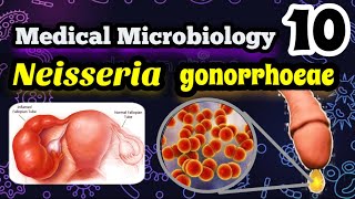 Neisseria gonorrhoeae شرح بالعربي البكتيريا المسببه لمرض السيلان وطرق علاجه [upl. by Rabah]