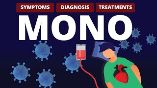 What is MONO Symptoms Diagnosis amp Treatments [upl. by O'Driscoll]