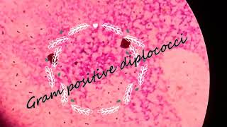 Gram positive diplococci steptococcus pneumoniae [upl. by Yousuf]