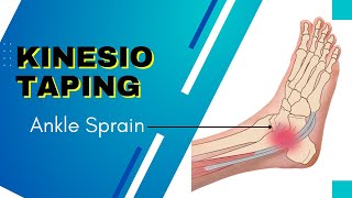 THE BEST and coolest Kinesiology Taping for an Ankle inversion sprain [upl. by Etnemelc963]