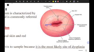 pap smear and colposcopy part 1 [upl. by Elocan]