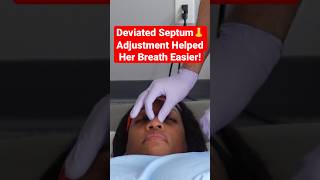 Deviated Septum 👃 Adjustment Helped Her Breath Easier shorts [upl. by Mace]