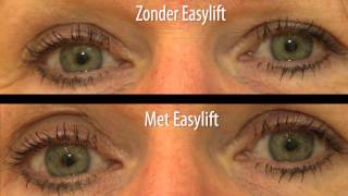 Easylift ooglidcorrectie van Telsell  Homeshopping Consumentenbond [upl. by Trudie]