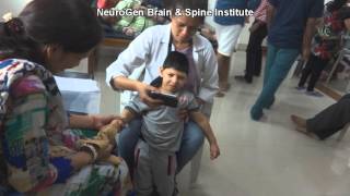 Treatment for Spastic Quadriplegia Cerebral Palsy [upl. by Naeerb]