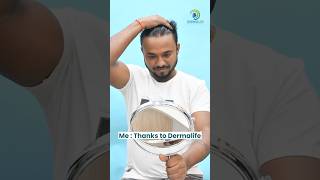 Hair Transplant Before After Result  Happy Patient After Hair Transplant [upl. by Iras]