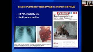 Leptospirosis Clinical Disease and Diagnosis in Humans [upl. by Jon486]