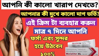 Melalite XL cream ফর্সা হওয়ার ক্রিম full review in bangla uses price dosage [upl. by Lenor]