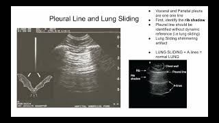 Introduction to Lung Ultrasound POCUS [upl. by Cloris]