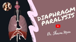 Diaphragm paralysis paradoxical breathing  injury to phrenic nerve [upl. by Rosalyn861]