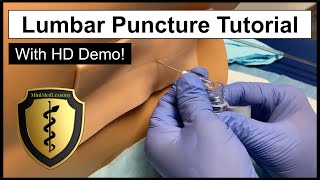 Lumbar Puncture Spinal Tap  Comprehensive Tutorial amp Demonstration [upl. by Philippa]