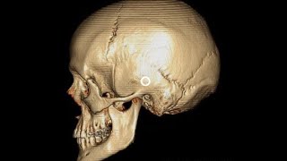 ANATOMIE FMPM OSTÉOLOGIE DU CRANE VS22 [upl. by Nnave775]