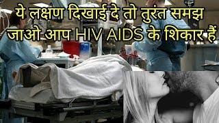 एड्स के लक्षणएच आई वी के लक्षणaids ke lakshanaids symptomshiv aids ke lakshan [upl. by Zavala]