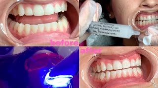 ADD TEETH WHITENING TO YOUR BEAUTY SERVICES  BELINDA ALMA [upl. by Tuckie]