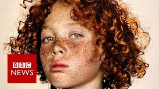 Celebrating freckles in all their glory  BBC News [upl. by Lehsreh826]