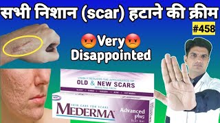 Mederma cream  mederma for acne scars  mederma advanced scar gel review [upl. by Arber262]