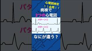 心電図検定必見！「〇〇房室ブロック」の見分け方！part18 心電図検定 心電図 看護師 [upl. by Leunamne716]