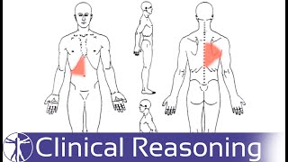 Radicular Pain Referred Pain and Radiculopathy  SYNOPSIS [upl. by Itoc885]