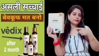 Vedix Honest Review After 2 Month use ll Vedix Hair Oil का असली सच 👎 ll [upl. by Philbin291]