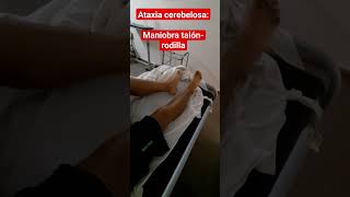 Ataxia Maniobra Talón Rodilla síndrome cerebeloso Mielonisis Funicular déficit B12 [upl. by Aitnecserc]