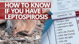 How to know if you have Leptospirosis Lifesaver [upl. by Melly]