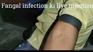 fangal infection in hindi [upl. by Dnallor]