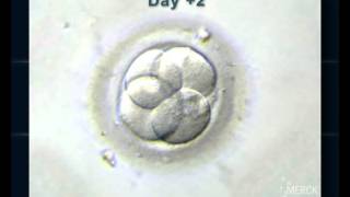 EMBRYO DEVELOPMENT UP TO BLASTOCYST [upl. by Tisdale]