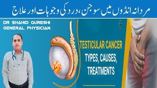 Testicular Cancer symptomscausestypesrisk factors and treatmenttesticularcancercancer [upl. by Chew748]