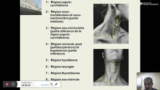 Diagnostic des tuméfactions cervicales Dr HAMZAOUI [upl. by Amsa]