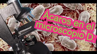 Cómo se ven los ÁCAROS a nivel MICROSCÓPICO [upl. by Hamlet805]