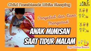 ANAK MIMISAN Saat Tidur Malam Jangan Panik Ini Penyebabnya [upl. by Harriman222]