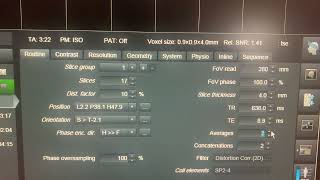 Adjusting MRI Parameters while Scanning [upl. by Dorwin573]