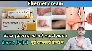 Ebernet cream use benefits and Side effects full review in hindi [upl. by Iturhs]