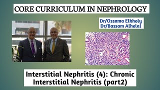 Interstitial Nephritis4 Chronic Interstitial Nephritis part 2 DrOssama Elkholy [upl. by Alleen]