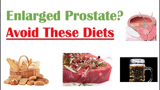 Foods to Avoid with Enlarged Prostate  Reduce Symptoms and Risk of Prostate Cancer [upl. by Garratt]