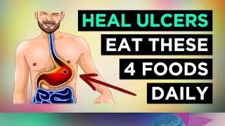 4 Foods To HEAL Stomach Ulcers Eat These Everyday [upl. by Eilata185]