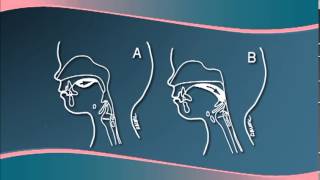 Chapter 3  Understanding Cleft LipPalate Physiology [upl. by Granny]