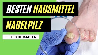 ✅ Nagelpilz behandeln  Die BESTEN Hausmittel zum entfernen [upl. by Eintrok]