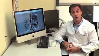 Qué es una Arteriografía o Angiografia  Cateterismo  ⭐ Radiologia Intervencionista Vascular [upl. by Darrey]